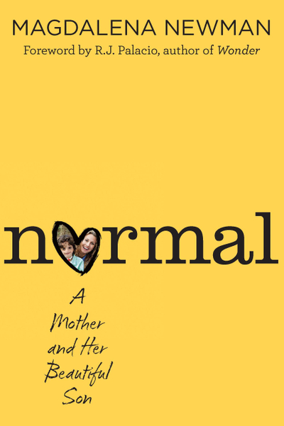 Normal