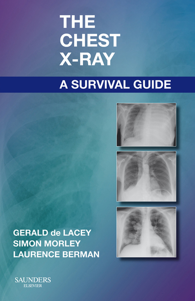 CHEST X-RAY A SURVIVAL GUIDE