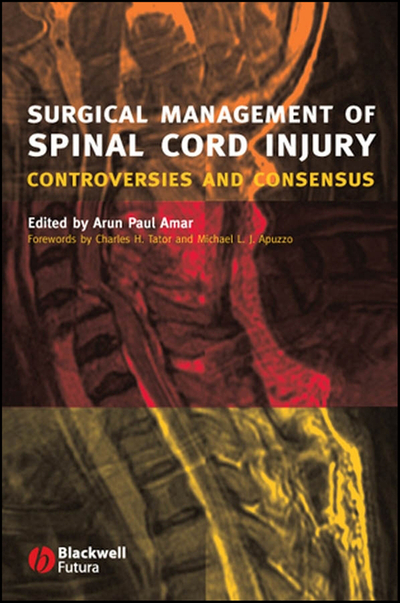Surgical Management of Spinal Cord Injury – DC eBOOKS
