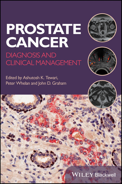 Prostate Cancer