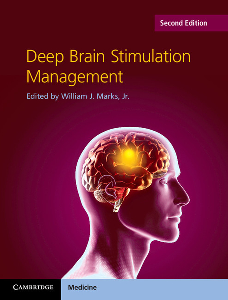 Deep Brain Stimulation Management – DC eBOOKS