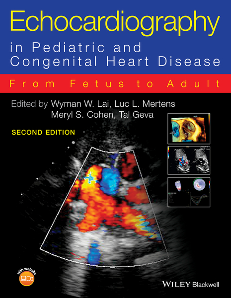 Echocardiography in Pediatric and Congenital Heart Disease – DC eBOOKS