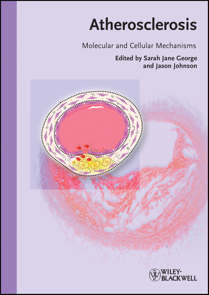 Atherosclerosis