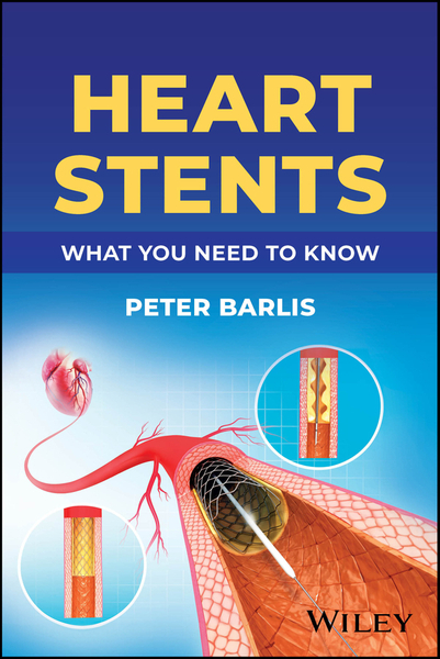 Heart Stents